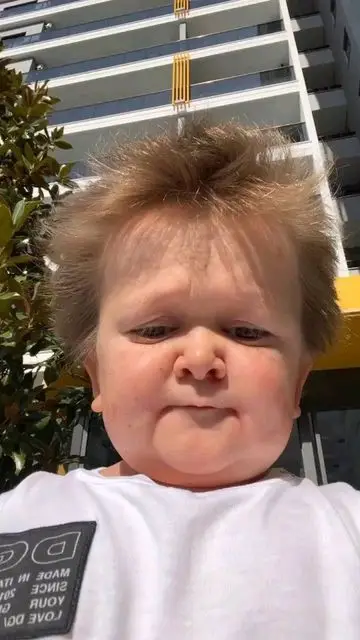 goofy-ahh-pictures-apple